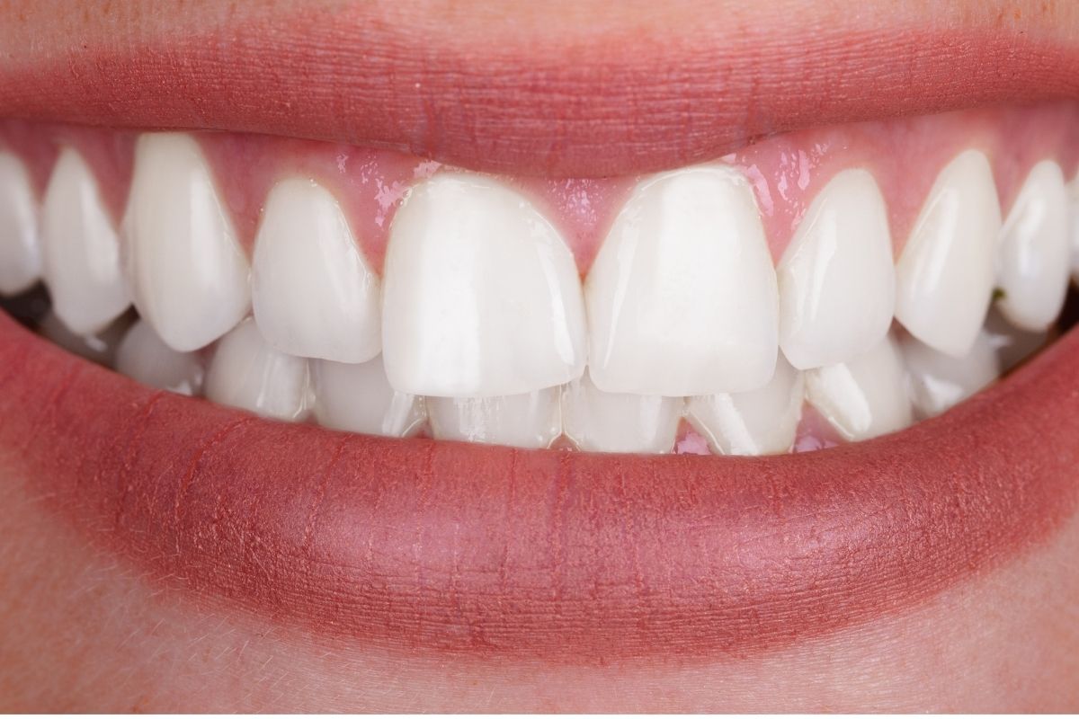 Dental Treatments Dental Treatments