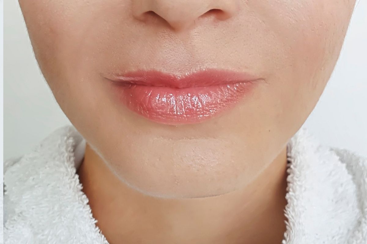 Aesthetic Surgeries Aesthetic Surgery After