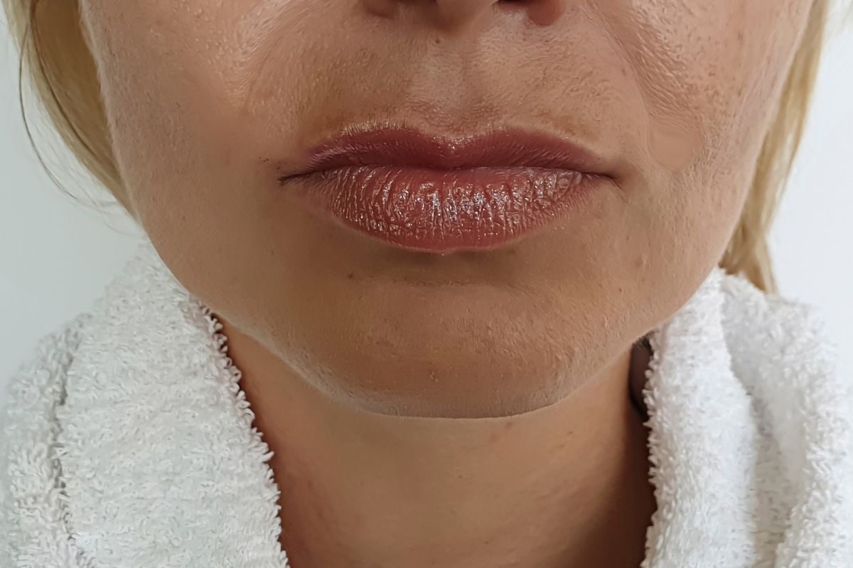 Aesthetic Surgeries Aesthetic Surgery Before