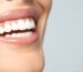 Dental Treatment