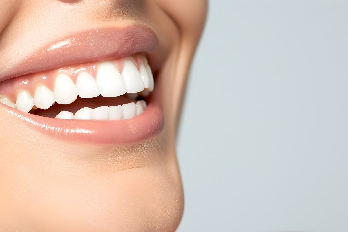 Dental Treatment in Antalya | Affordable & High-Quality Care Dental Treatment